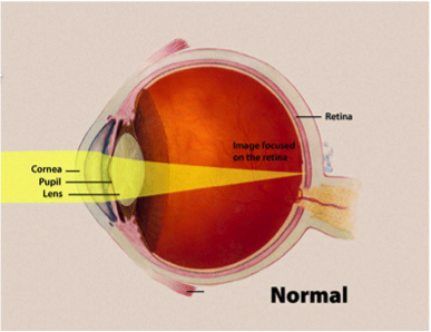 labeled-diagram-of-the-eye